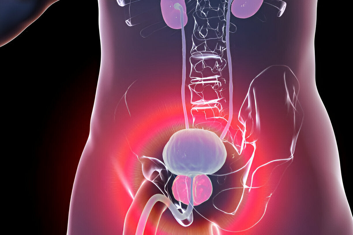 Benign prostatic hyperplasia, illustration