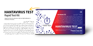 HANTAVIRUS TEST